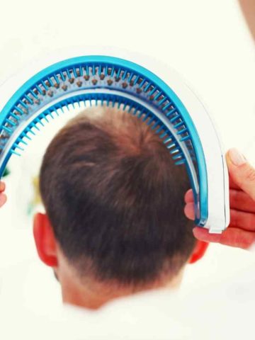 Hair Loss Treatments