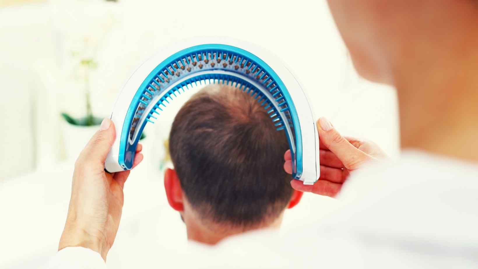 Hair Loss Treatments